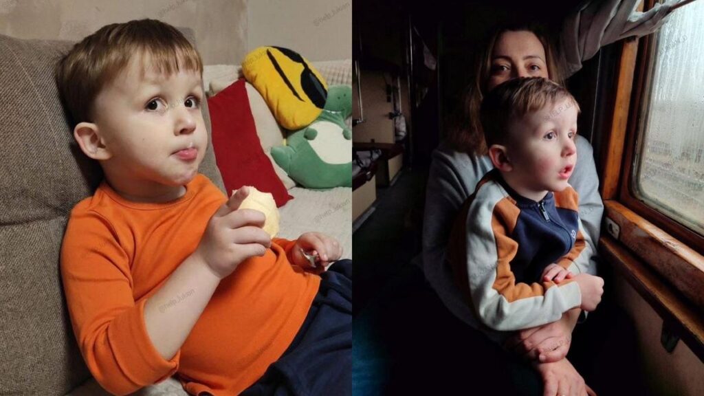 Хлопчик з рідкісною хворобою потребує допомоги